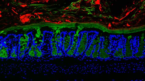  Reticulomyxa:  A Tiny Blob With A Big Appetite For Bacteria!