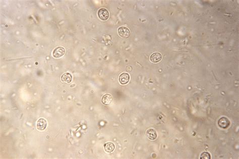  Kryptosporidium: Sürünerek İlerleyen Mikroskobik Bir Canlı mı Yoksa Suya Dalmış Bir Gökkusu mu?