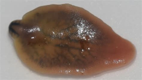  Liver Fluke: A Tiny Parasite That Can Pack a Punishing Punch!